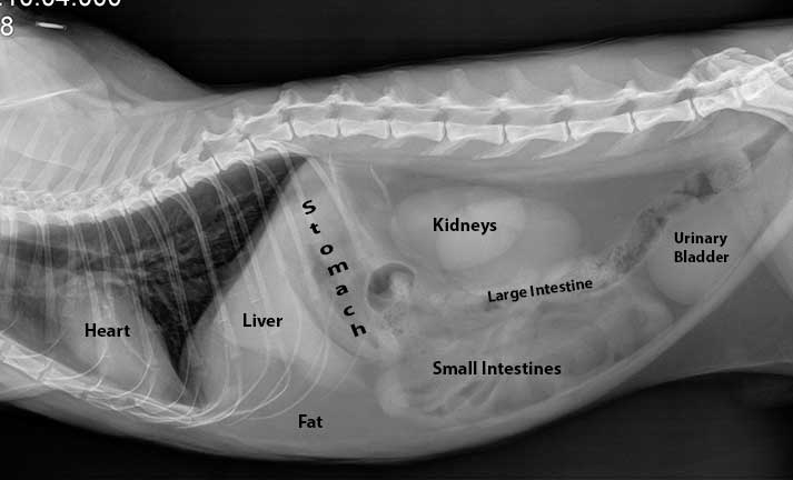 radiograph-kidney