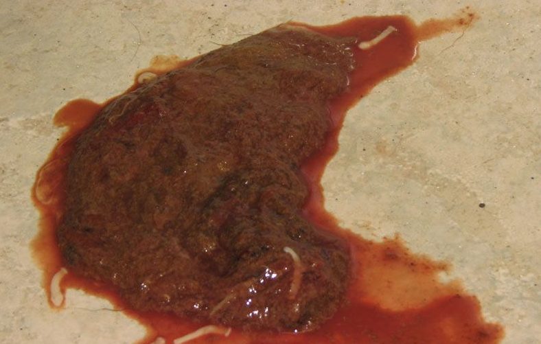 blood in poo